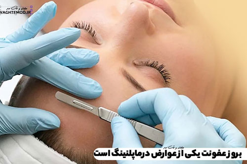 خطرات و عوارض درماپلنینگ