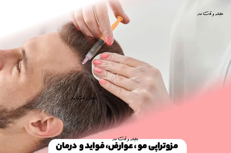 مزوتراپی مو چیست؟ عوارض، فواید و تاثیر مزوتراپی برای درمان ریزش مو