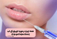 تزریق ژل لب برای حجم دهی به لب