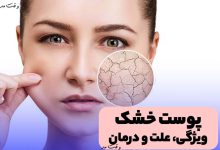 علایم و ویژگی پوست خشک