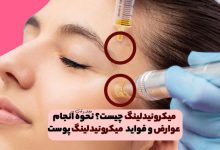 میکرونیدلینگ چیست؟ نحوه انجام، عوارض و فواید Microneedling پوست را بدانید!