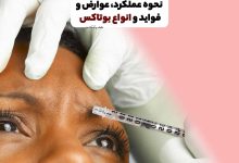 بوتاکس چیست؟ نحوه عملکرد، عوارض، فواید و انواع بوتاکس