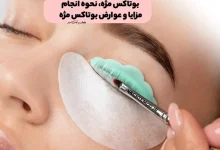 بوتاکس مژه چیست؟ نحوه انجام، هزینه، مزایا و عوارض بوتاکس مژه